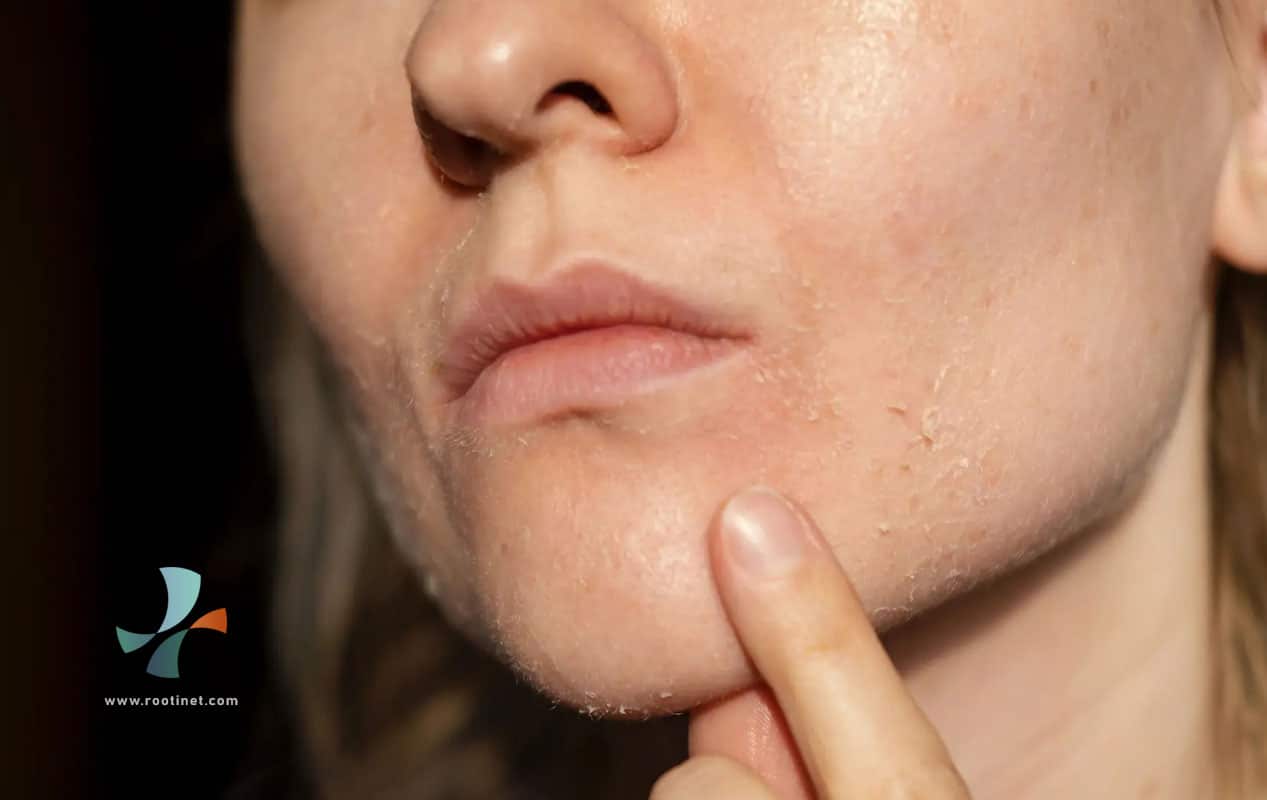 skin-routine-for-dry-skin-rootinet-03
